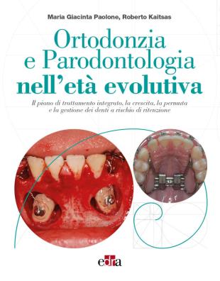Ortodonzia e parodontologia nelletà evolutiva. il piano di trattamento integrato, la crescita, la permuta e la gestione dei denti a rischio di ritenzione